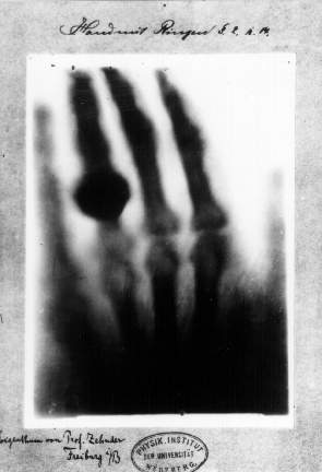 x-ray 1895