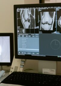 How Diagnostic Imaging Centers Can Benefit from Teleradiology
