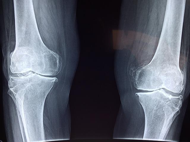 bone density x-ray