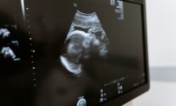 ultrasound imaging