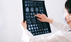 brain studies news
