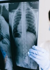 AI in Radiology: Biden’s New Executive Order and Latest News