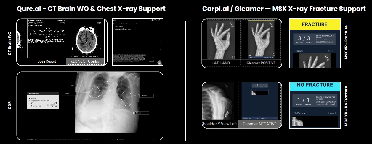 teleradiology-with-ai-support